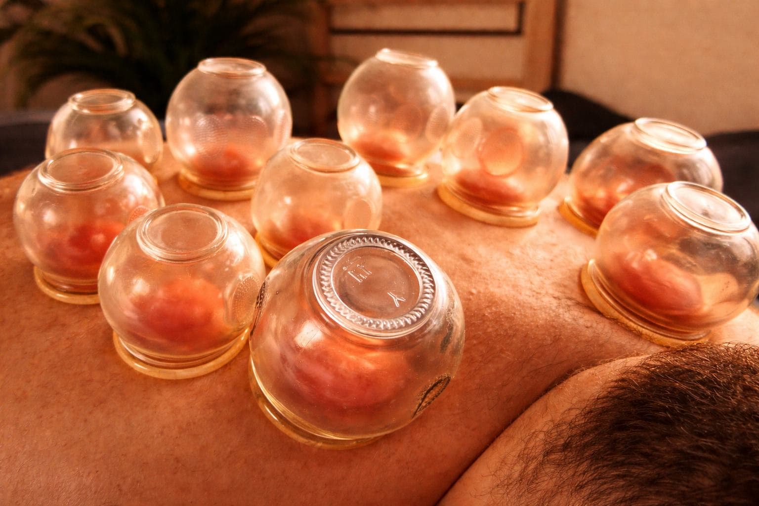 Odczyn po bańkach. Co oznaczają kolory i jak interpretować reakcję skóry w fizjoterapii.